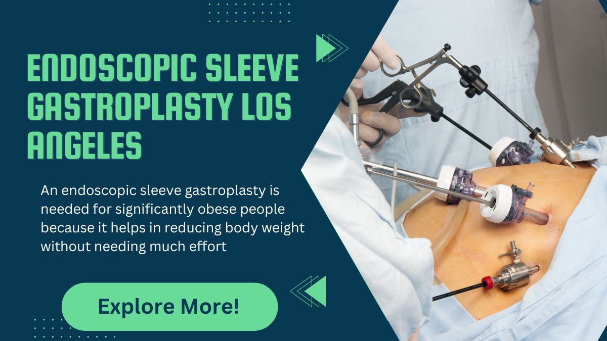 What is an Endoscopic Sleeve Gastroplasty (ESG)?