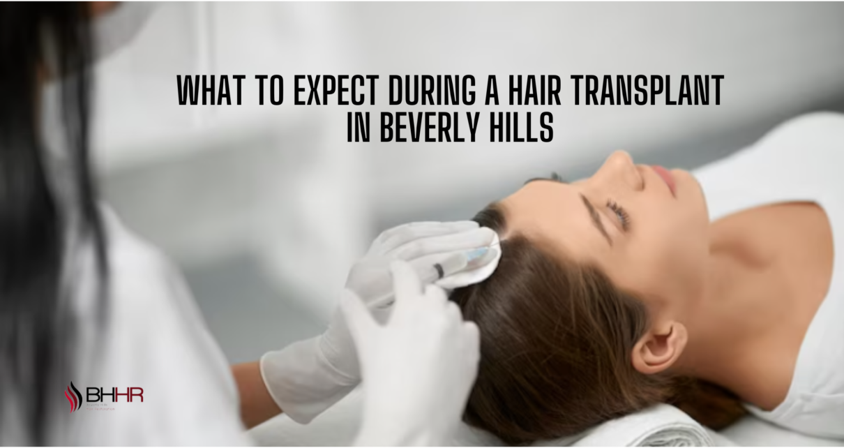 hair transplant in beverly hills