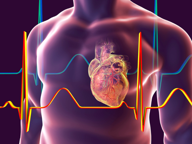 ecg test