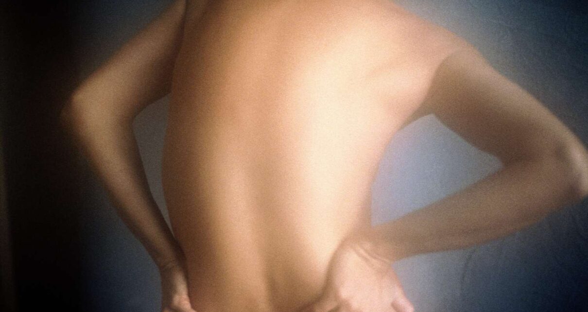 Levoscoliosis