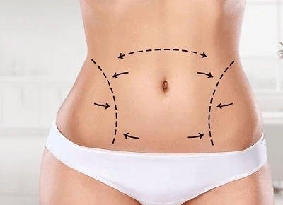 Best Liposuction in Abu Dhabi