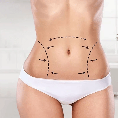 Best Liposuction in Abu Dhabi