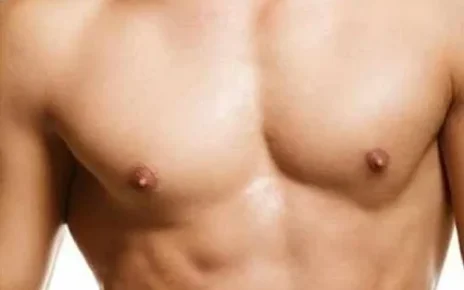 gynecomastia surgery in dubai