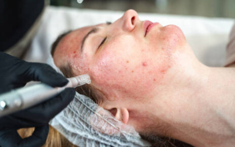 Abu Dhabi Skin Diseases Treatment