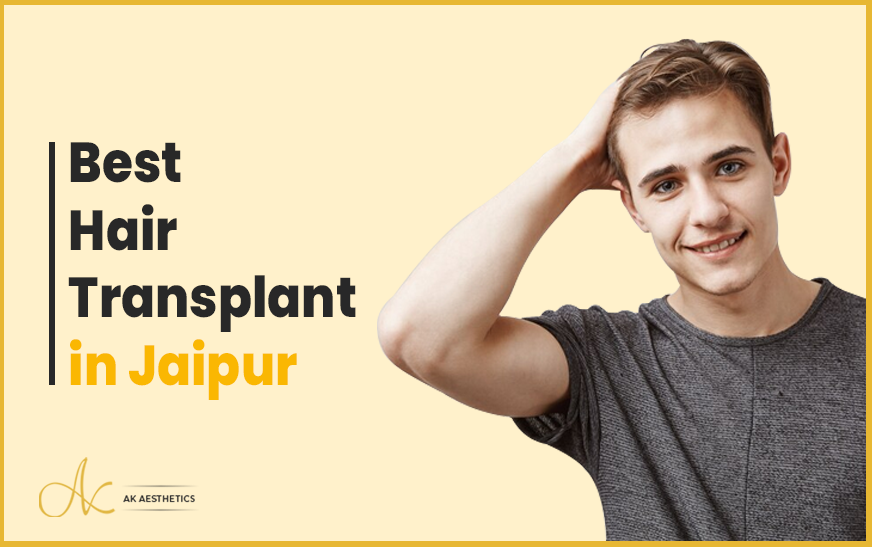 Best Hair Transplant in Jaipur - Dr Akangsha Sharma