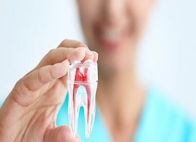 Root Canal Treatment in Islamabad